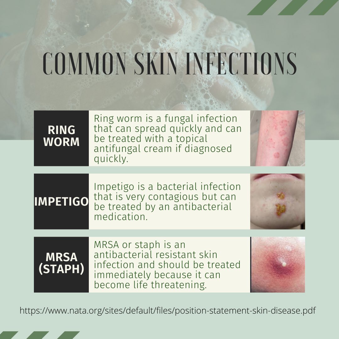 Week 2 Day 2 of Safety in Football 🏈 At any given time, one out of every three people in the United States suffers from a skin disease. #ATSafetyinFootball <a href="/MAATAD5/">MAATA District 5</a> <a href="/NATA1950/">NATA</a>