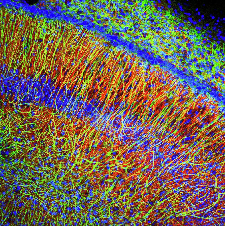 chrost_hugo's tweet photo. A fluorescence light micrograph of numerous glial cells and neurons.
Credits: Dr. Chris Henstridge
#neuroscience #neurotwitter #science #sciencetwitter #radiology #neurology #Bioinformatics #biochemistry #anatomy #MedTwitter https://t.co/w8OTgZSgH3