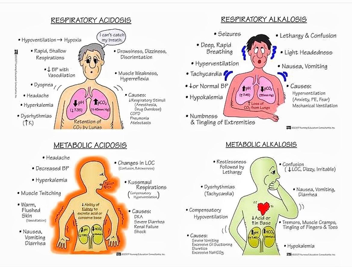 BrownJHM's tweet photo. Acid base disorders &amp; clinical manifestations (Nursing Education) #BJHM #MedEd #Medtwitter #Nephpearls #FOAMed #familymedicine #medstudenttwitter https://t.co/fN5akVYZRz