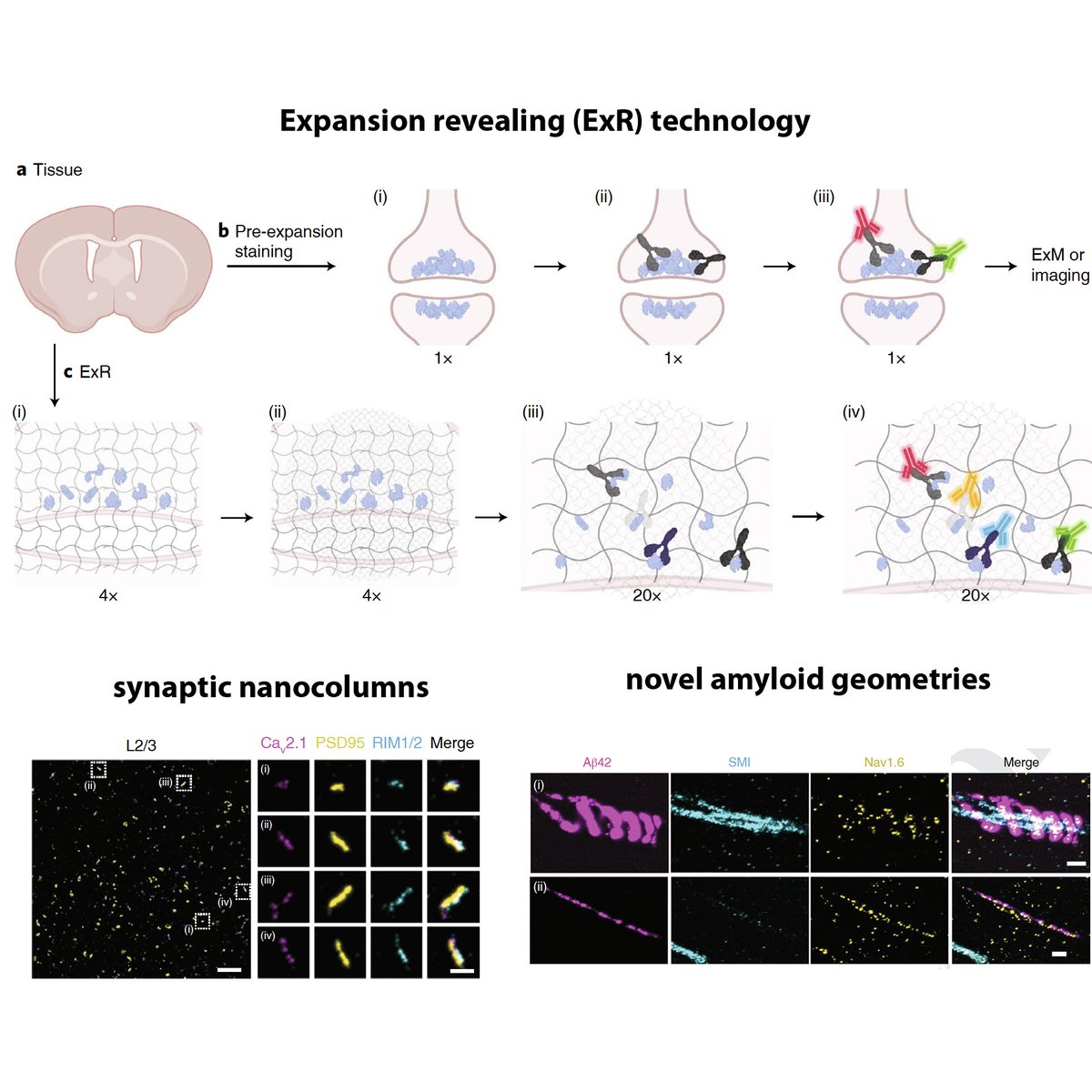 Ed Boyden (@eboyden3) on Twitter photo Just published in <a href="/natBME/">Nature Biomedical Engineering</a>: expansion revealing (ExR), a 20x #expansionmicroscopy method that evenly separates proteins from each other for better antibody labeling, and nanoprecise imaging, on ordinary microscopes. Link to PDF: rdcu.be/cUyAO Just published in <a href="/natBME/">Nature Biomedical Engineering</a>: expansion revealing (ExR), a 20x #expansionmicroscopy method that evenly separates proteins from each other for better antibody labeling, and nanoprecise imaging, on ordinary microscopes. Link to PDF: rdcu.be/cUyAO