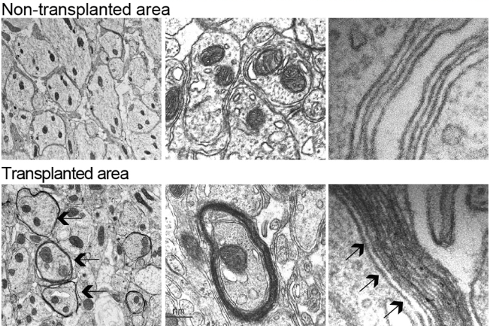 Dev_journal's tweet photo. In their Open Access Research Article, Koji Tanabe, Hiroko Nobuta, Marius Wernig @WernigLab and colleagues present their protocol for rapid generation of human oligodendrocytes from human dermal fibroblasts. 2/10
#OpenAccess #ReadandPublish
https://t.co/zPmsdVOQkT https://t.co/0jzG3QxKol
