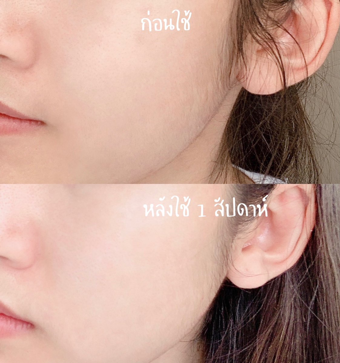 Eves_th's tweet photo. หลังลองใช้มา 1 สัปดาห์ รู้สึกว่าหน้านุ่มฟูขึ้น แถมเหมือนพวกจุดด่างดำค่อยๆ จางลง เนื้อครีมซึมง่าย ไม่เหนอะหนะ โดยรวมคือประทับใจให้ 10/10 ซื้อต่อแน่นอนจ้า #ใช้จริงรีวิวจริง
ขอบคุณสำหรับรีวิวมากๆ นะค้า 🙏🏻💙
Cr. Twitter : @nphchda
#EVES #ครีมเจลอีฟส์ #รีวิวจากผู้ใช้eves #ใช้ดีบอกต่อ https://t.co/pRIxGFvhGD
