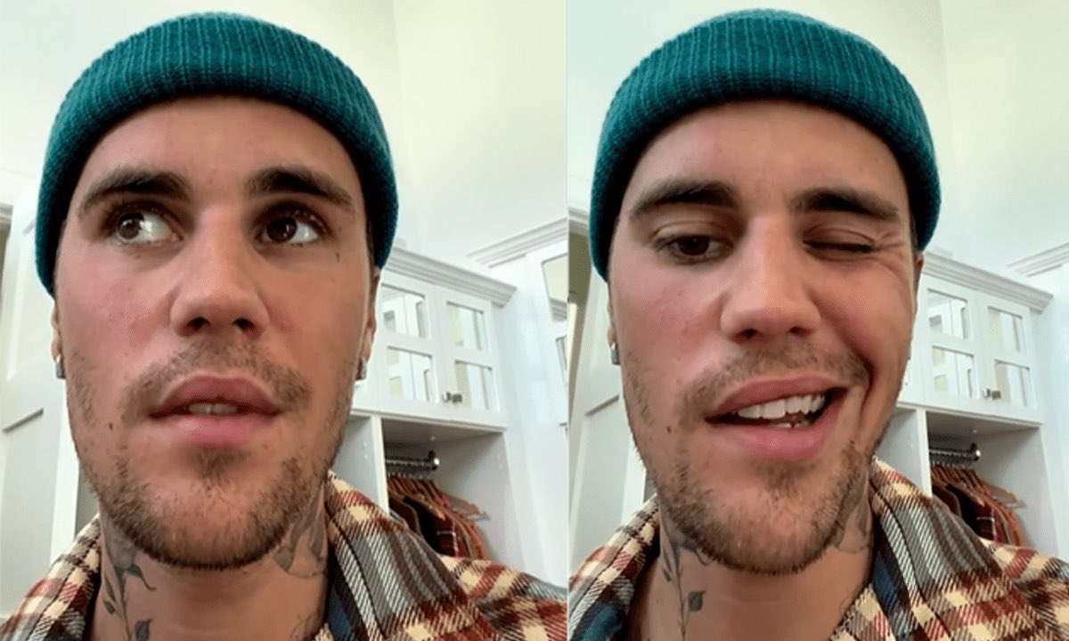justin bieber veio a público recentemente para explicar q foi diagnosticado com uma síndrome que paralisa o rosto e q foi preciso cancelar alguns shows. TODO mundo o apoiou, deu suporte para ele. porque só aqui no brasil o pessoal o ataca?#JusticeWorldTour