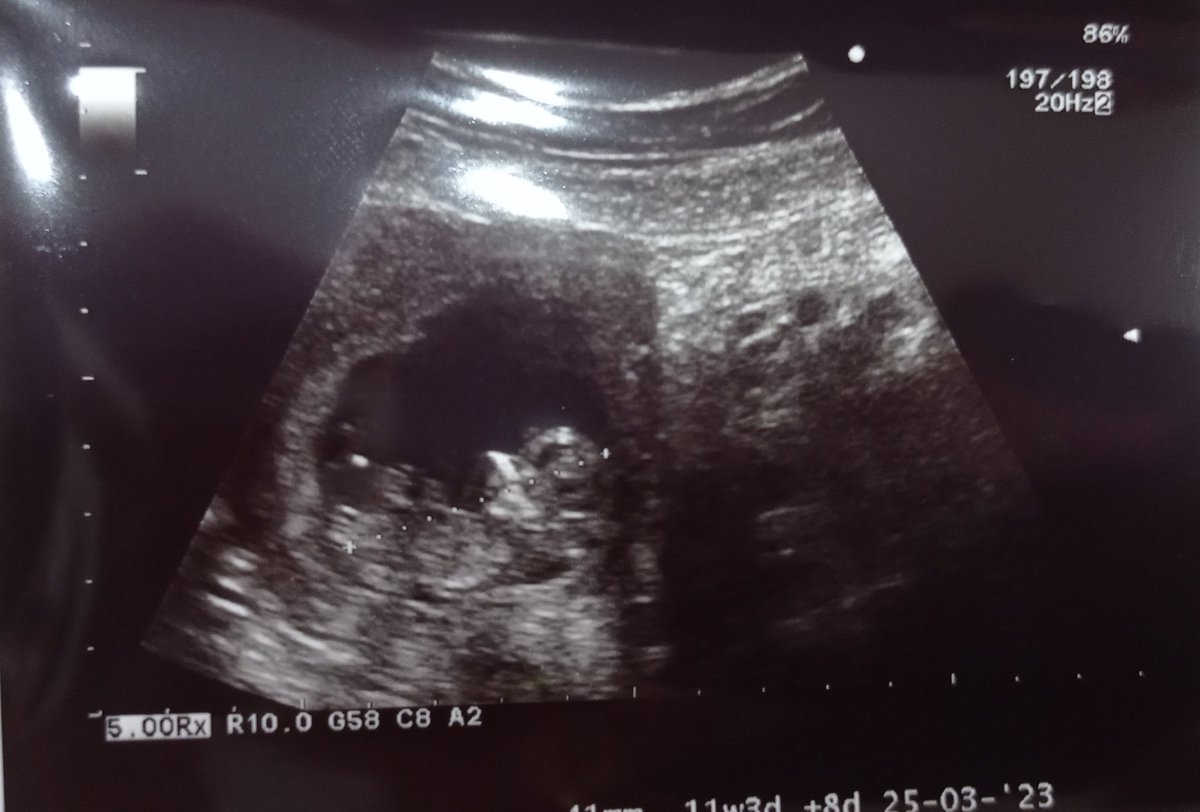 𝕮𝖍𝖎𝖇𝖎 💜Animae dimidium meae💜 tweet media