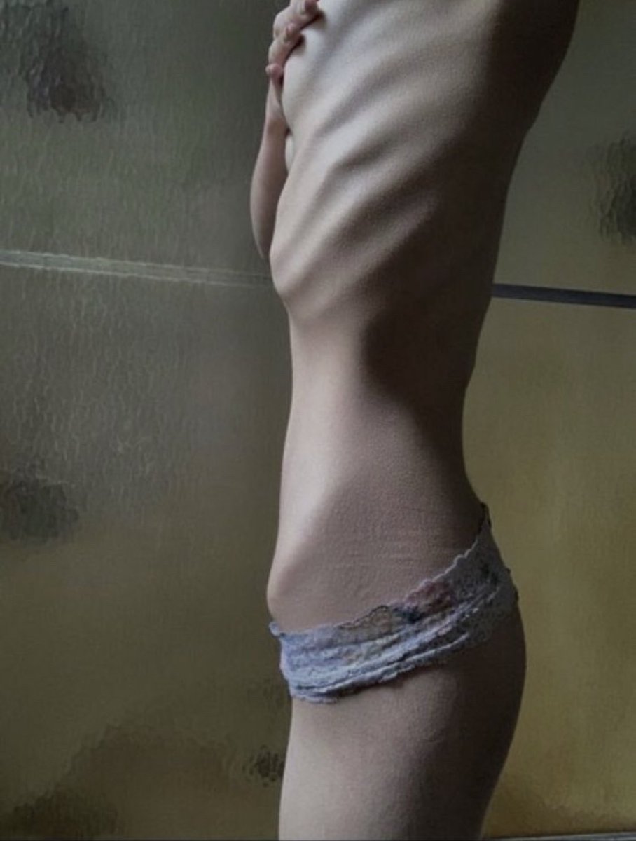 tinycalss_'s tweet photo. im so happy to be back, i unfortunately had a few months of recovery that i didnt want. i hope everybody’s still active and having lots of progress!!! :) <3 remember to be safe! #thinspo #bonespo #skinny #skinnygirls #thighgap #thighspo #anarex https://t.co/t1ffXRO0rV