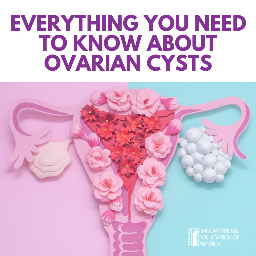 Endofound's tweet photo. https://t.co/qHX8BhdQEB has a ton of #endometriosis resources and we're highlighting our Ovarian Cysts 101 info page. Learn more about every type of #ovariancyst, including the ones that could point to #endo: https://t.co/L2sE5HlTl2 https://t.co/oI5bRLBEUj