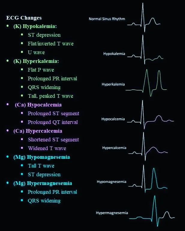 PatologCritica's tweet photo. #ECG y #Electrolitos: Cambios⬆️⬇️!!!
👉K #Potasio
👉Ca #Calcio
👉Mg #Magnesio
Buen resumen visual🫀!!! https://t.co/rq9XwXuUky