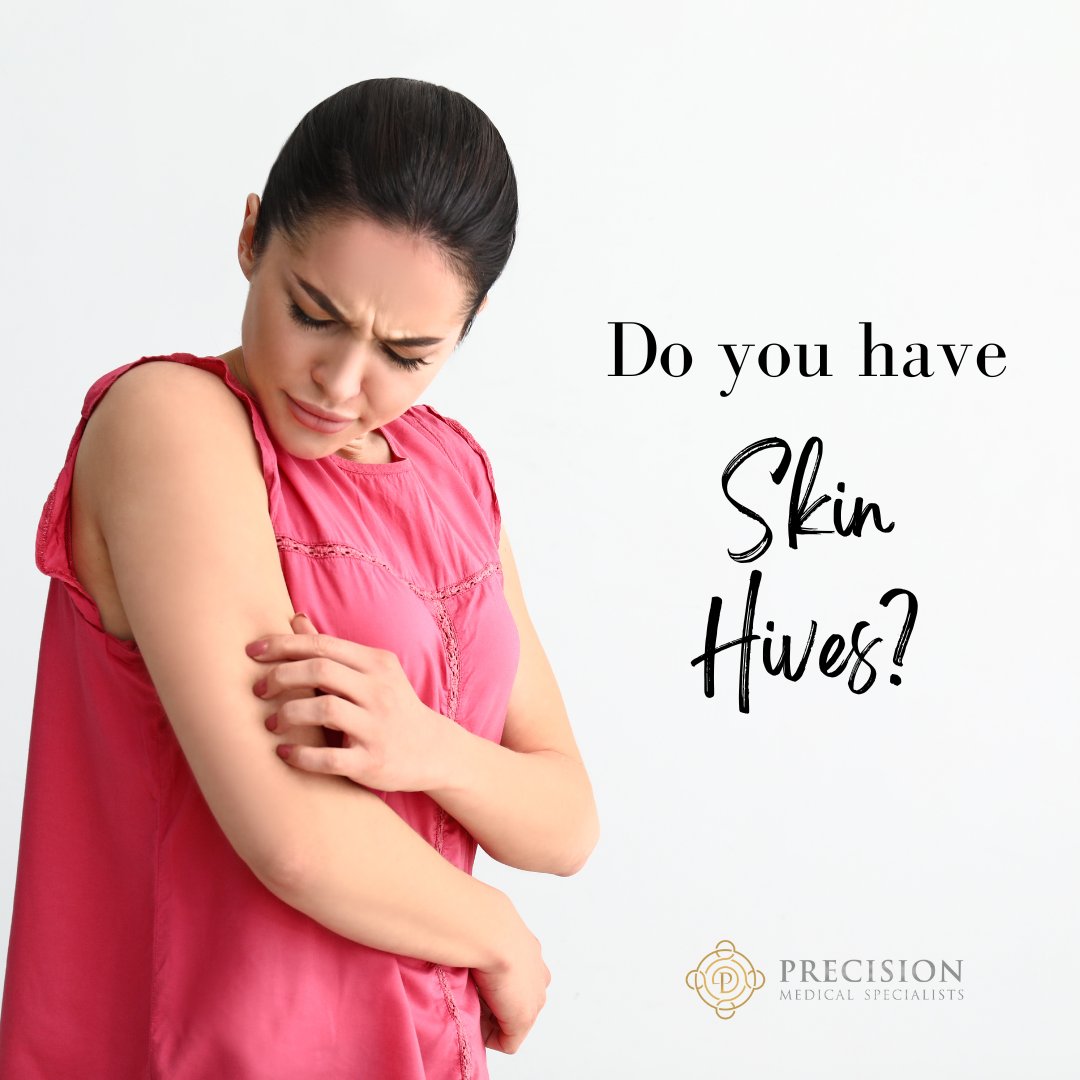 PrecisionMDs's tweet photo. If you have severe hives and want to learn more about your treatment options, come see our medical team at Precision Medical Specialists.
#tuesdaytips #precisionmedicalspecialists #precisionmds #hives #skinhives #dermatology #palmbeachdermatology #palmbeachplasticsurgery https://t.co/EWJ84T8GTZ