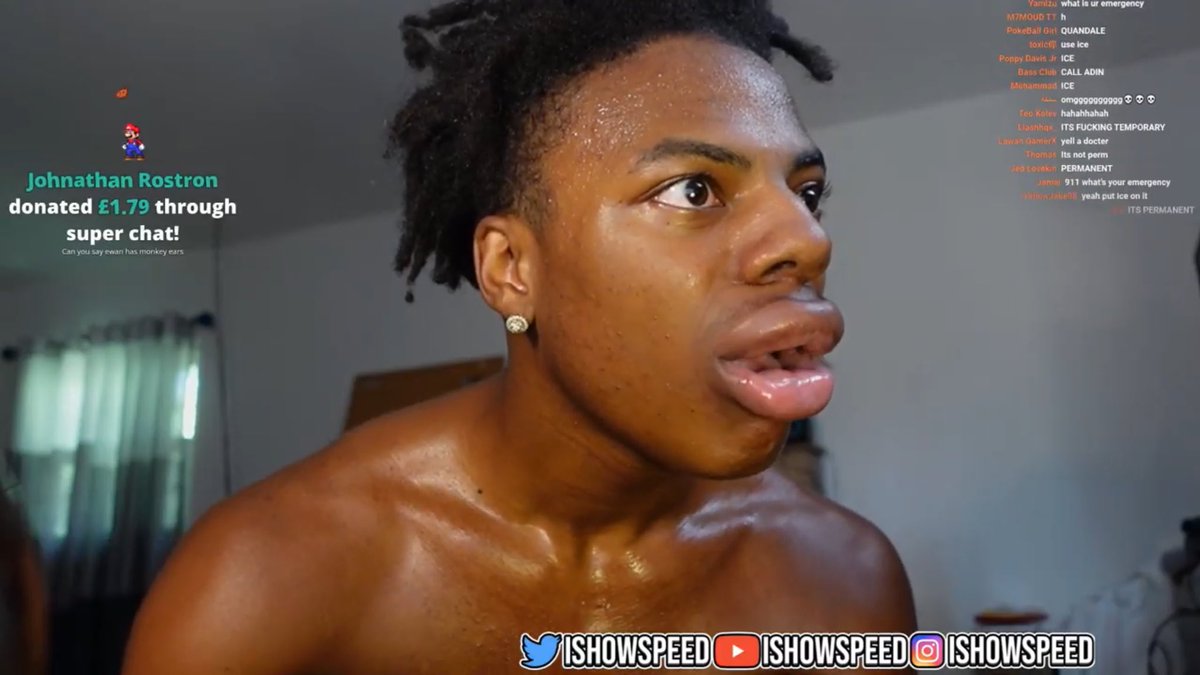RXJtakesOnLife's tweet photo. iShowSpeed is fkinn crazy ,man tried the technique to increase his lip size and this happened 💀
#ishowspeed #speed #dramalert @DramaAlert @ishowspeedsui #meme #funny #laugh #ChampionsLeague #แบนลีน่าจัง #SHUTDOWN #captaincy #RohitSharma #Cyberpunk2077 #CricketTwitter https://t.co/v9dSBMAepA