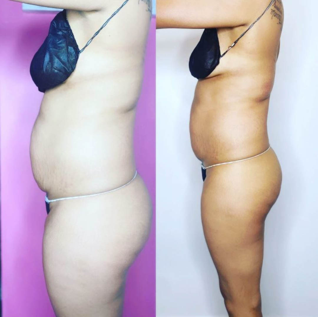 SnatchingBLA's tweet photo. Did you know that SnatchingBodiesLA offers outstanding Weight Loss Shop services in the Hermosa Beach area? For more information, come visit us or click on the link below to view our website! #WeightLossShop https://t.co/CgY9tbdMfc https://t.co/xeE95D3BEN
