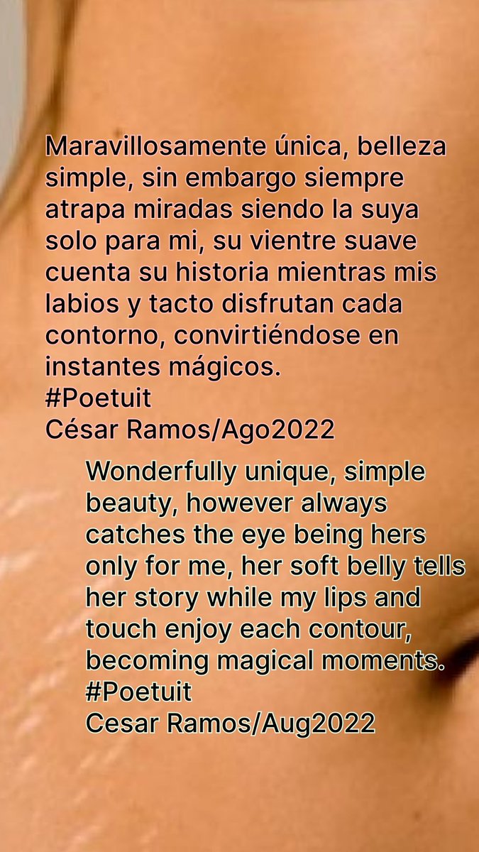 Maravillosamente única, belleza simple, sin embargo siempre atrapa miradas siendo la suya solo para mi, su vientre suave cuenta su historia mientras mis labios y tacto disfrutan cada contorno, convirtiéndose en instantes mágicos. #Poetuit César Ramos/Ago2022