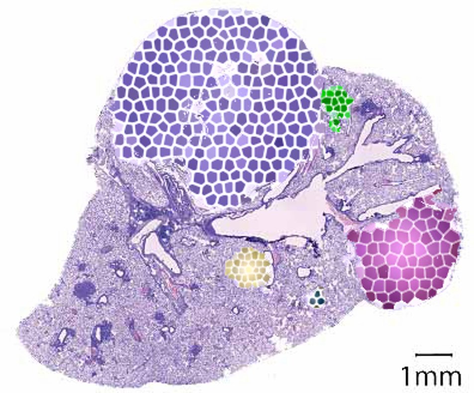 Emilio Casanova (@emiliocasanova9) on Twitter photo We have an open Postdoc position in lung cancer at the Medical University of Vienna, Vienna, Austria
Apply here!
fwf.ac.at/en/service/fwf…
Please, RT We have an open Postdoc position in lung cancer at the Medical University of Vienna, Vienna, Austria
Apply here!
fwf.ac.at/en/service/fwf…
Please, RT