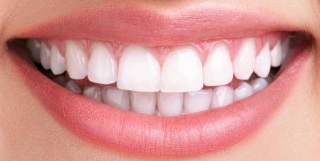 20B__'s tweet photo. اشياء مرررره مهمة تحتاجونها عشان تصير ريحة فمكم منعشة وعشان تحافظون على أسنانكم لين تصيرون شيبان ، تابعوا معي الثريد https://t.co/WFzDTiCD79