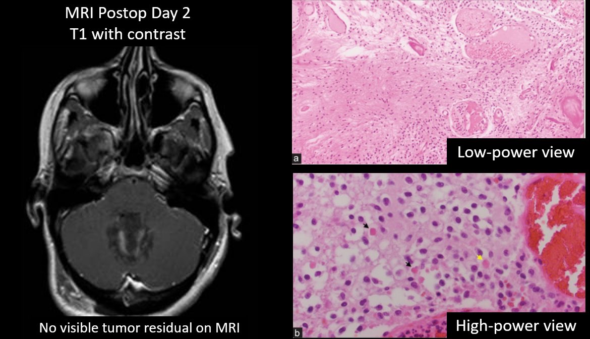 Jacques Morcos MD FRCS FAANS tweet media