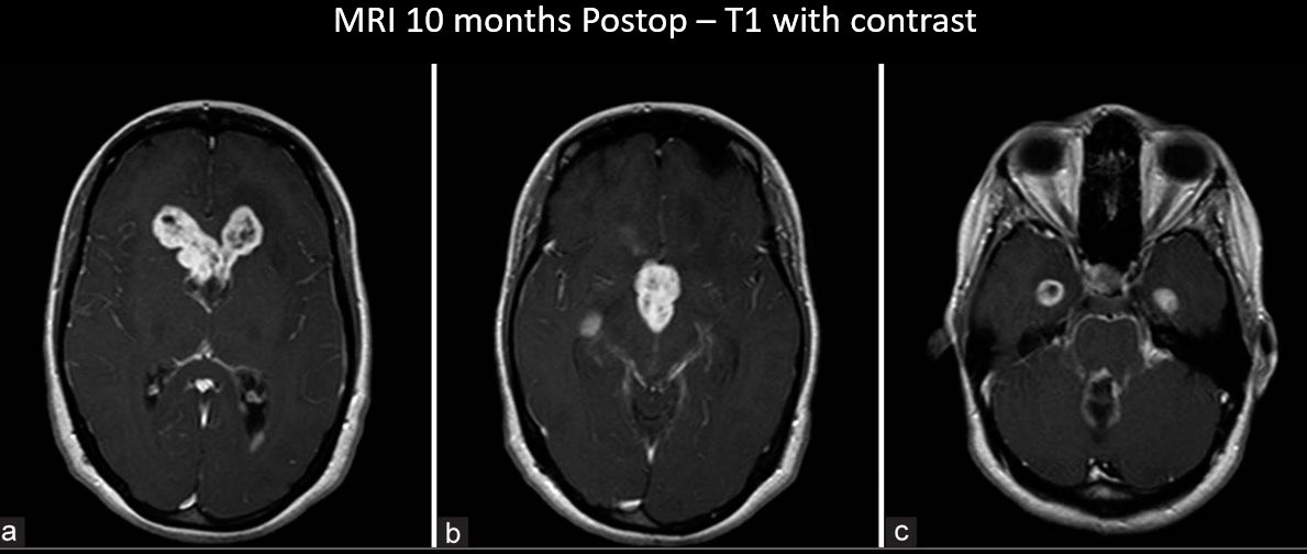 Jacques Morcos MD FRCS FAANS tweet media