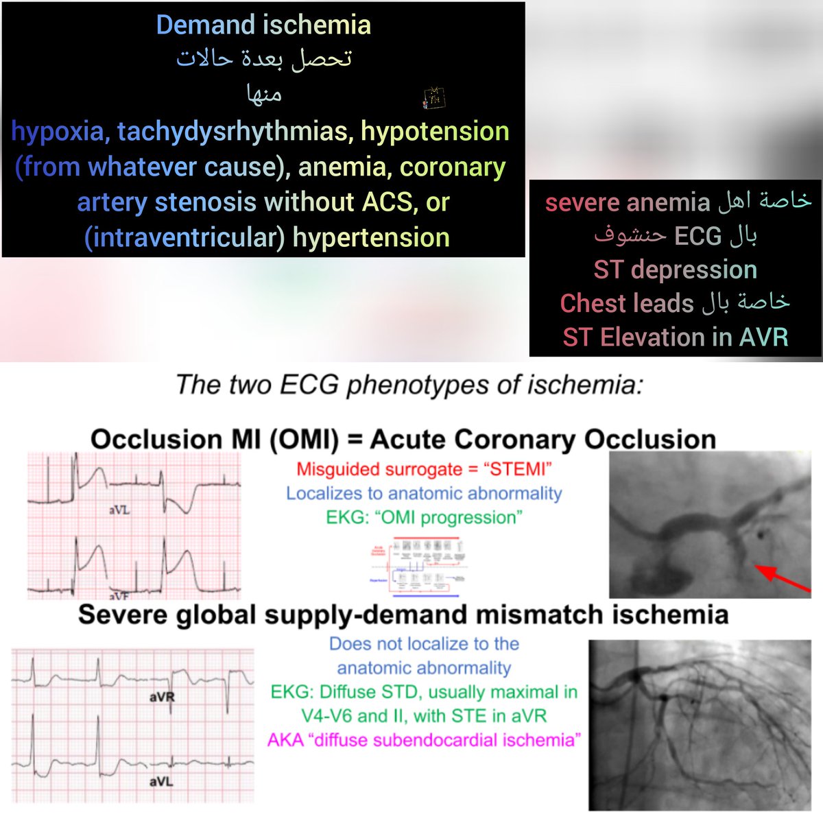 MTH977's tweet photo. #المنطقة_الخضراء
#ECGproductions
#EmergencyMedicine https://t.co/SMAOFGPysi