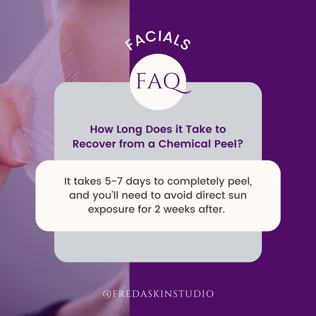 FredaSkinStudio's tweet photo. Recovering from a chemical peel 🧖🏼‍♀️

Every type of peel and everyone’s skin is different, so every time you get a peel your skin may react different. Typically it takes about 48-72 hours to start peeling. During that time you should avoid exercising or anything th https://t.co/7ftZ8hUCTh