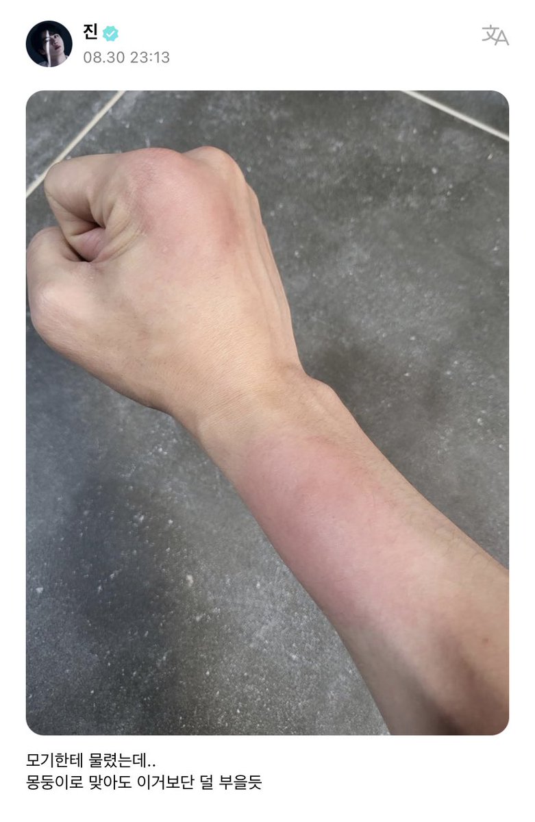 btsinthemoment's tweet photo. jin weverse post
🐹 i got bit by a mosquito but..
i feel like even if i got hit by a bat it would be less swollen than this https://t.co/RmkXsfXueX