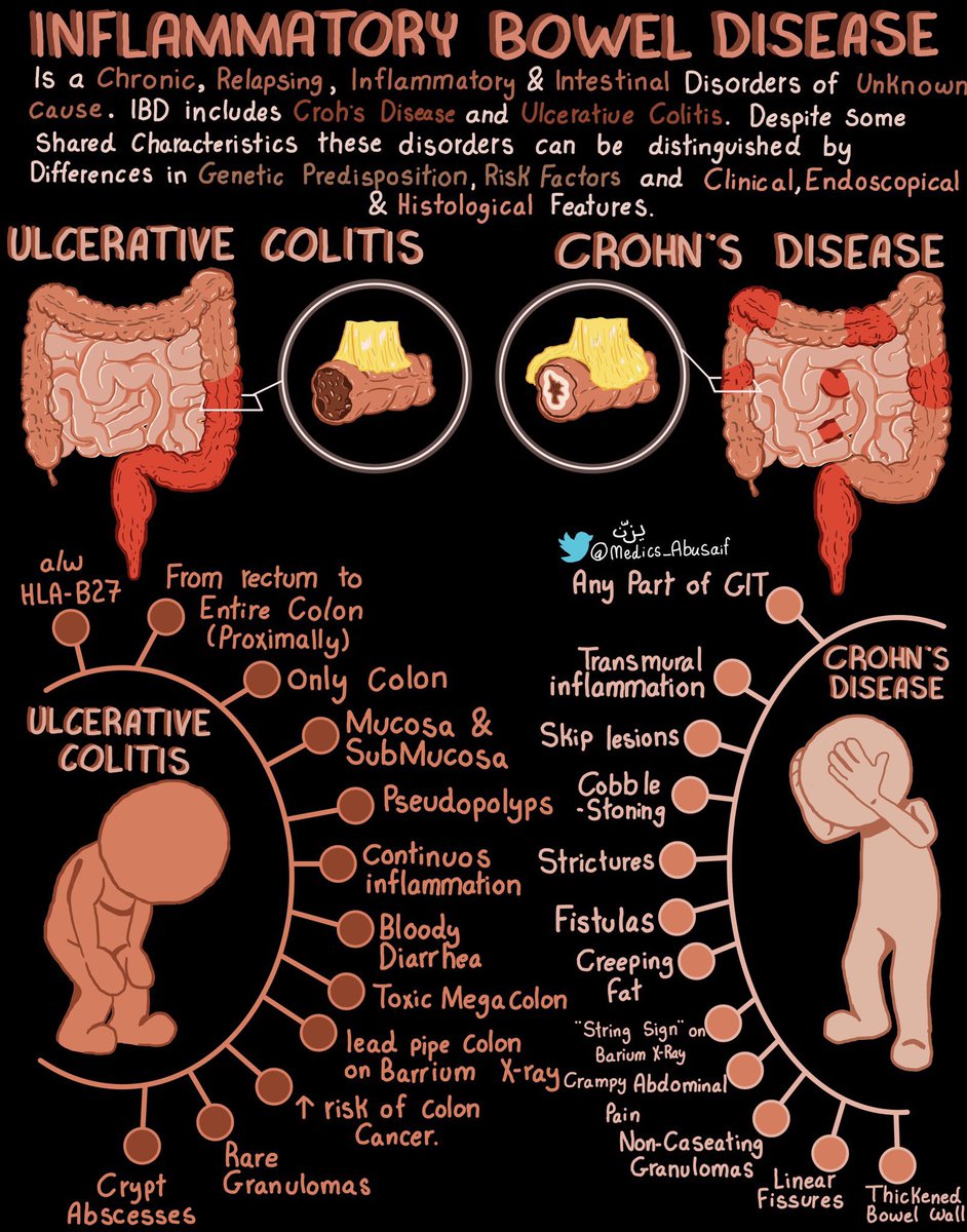Inflammatory bowel disease <a href="/medics_AbuSaif/">يـزّن الغماس</a> #BJHM #MedEd #Medtwitter #GITwitter #IBD #FOAMed #medstudenttwitter