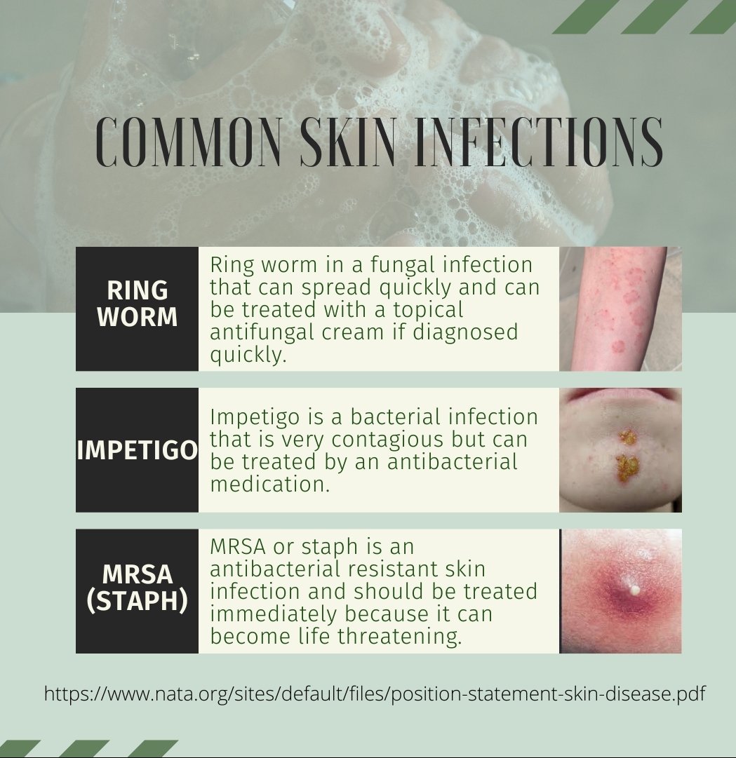 egglestallion's tweet photo. Skin disease is one of the top 15 groups of medical conditions for which prevalence and health care spending grew the most between 1987 and 2000, exceeding spending rate increases for diabetes, cerebrovascular disease and cancer. #ATSafetyinFootball @NSATA https://t.co/hwHbM47RE6