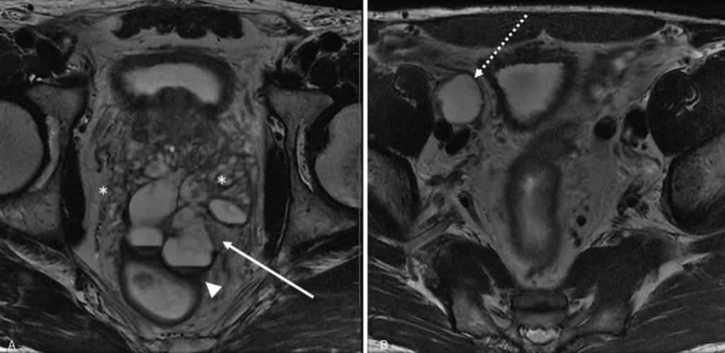 Anton Becker, MD, PhD tweet media