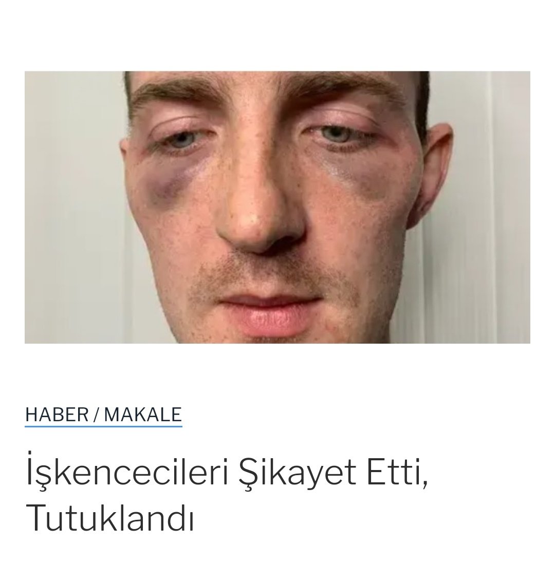 kafhakorg's tweet photo. https://t.co/rjsnDNY0Nq, polisleri kendisine işkence yapmakla suçlayan Soçili Alexei Vlasenko'ya sahte ihbar sebebiyle ceza davası açıldığını ve tutuklanmasına karar verildiğini bildirdi. 

https://t.co/RxOirTRpgt… https://t.co/Cs5zpWKSY7