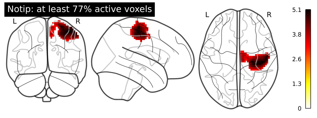 Alexandre Blain (@alexandrebln) on Twitter photo How many active voxels are there in this cluster ? This question can be addressed using Notip: Non-parametric True Discovery Proportion control for brain imaging published in <a href="/NeuroImage_EiC/">NeuroImage</a>
Pre-print: arxiv.org/pdf/2204.10572… How many active voxels are there in this cluster ? This question can be addressed using Notip: Non-parametric True Discovery Proportion control for brain imaging published in <a href="/NeuroImage_EiC/">NeuroImage</a>
Pre-print: arxiv.org/pdf/2204.10572…