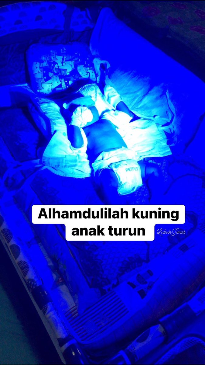 shopeesale's tweet photo. Alhamdulilah anak dah turun kuning lepas guna lampu ni. Memang dah spare sebelum bersalin lagi.

Saya beli sini 👉🏻 https://t.co/EV9DvJDJya

Anak tak perlu admit hospital. Just guna ni je. Sebelum ni sewa dekat klinik, rm250 utk 2 hari. Mahal 🥲🥲 https://t.co/xtYTOE5qhs