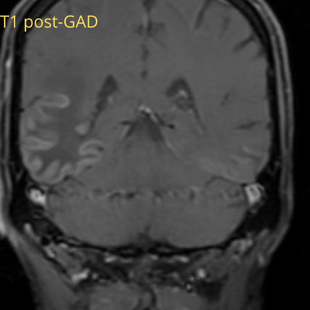 NeuroimagingN's tweet photo. https://t.co/kheRtXZZEh