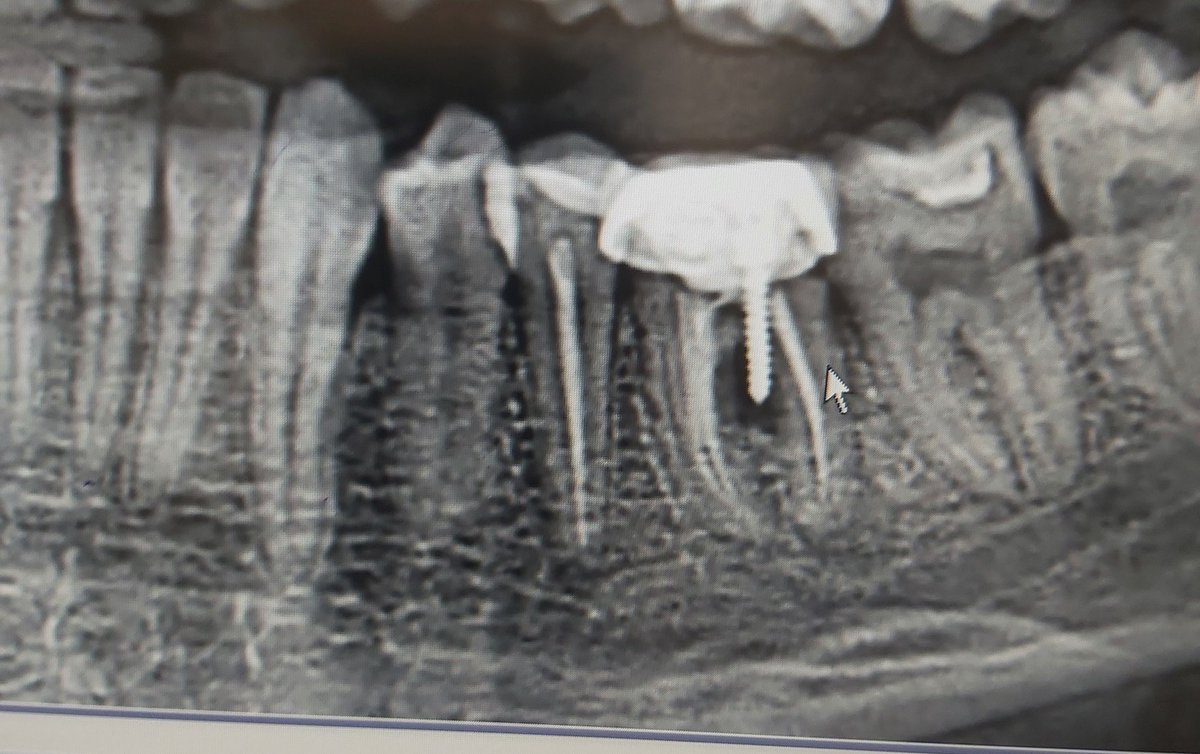 Kilimcinin kör oğlu yapmış