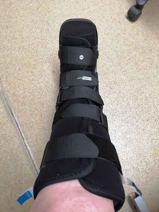skipper68uk's tweet photo. In the words of Brittany Spears.. Oops I did it again
ankle gave way again and down i went ... 3rd fracture on this ankle so far xx #fracture #bootcast #xray #NHS https://t.co/cLOrs5osBv