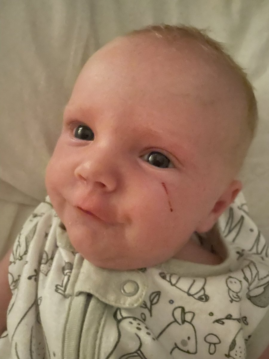Cannot recommend <a href="/RochelleHumes/">Rochelle Humes</a> My Little Coco brand enough! I used the ‘My little everything balm’ on my sons nasty scratch and after 2 days it completely cleared up, happy fresh faced boy now 💙 #MyLittleCoco