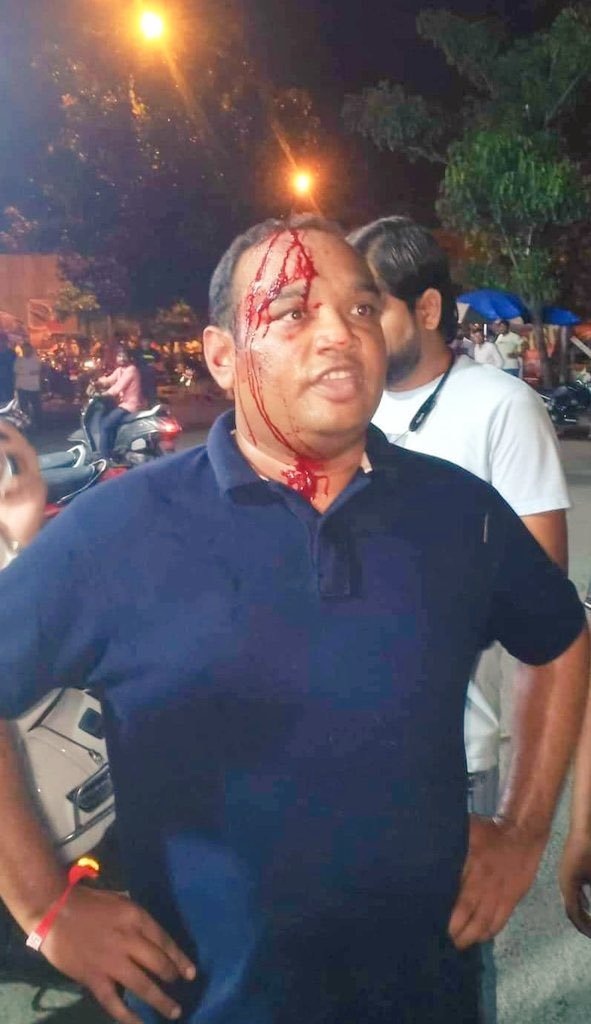 SanjayAzadSln's tweet photo. गुजरात का शेर है @manoj_sorathiya कायर भाजपाई गुंडों के सामने सीना तानकर खड़ा है।
@manoj_sorathiya के एक-एक बूँद के खून का हिसाब गुजरात की जनता लेगी।
@manoj_sorathiya के बहादुरी और जज़्बे को सलाम। https://t.co/QNyNDJLccK