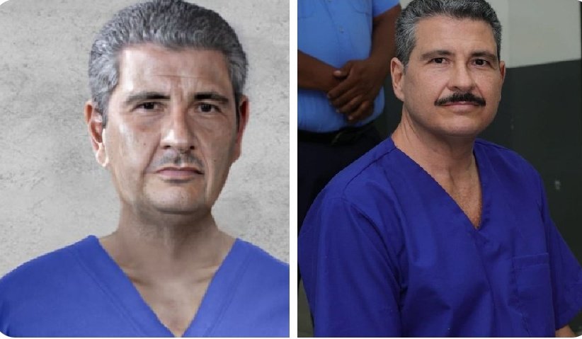 Antes y después. 

No pegan ninguna los puchos.