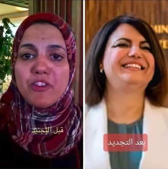 zmrdt67405634's tweet photo. اجمل أفاعي ليبيا من ؟ https://t.co/EA6UUNf0Xx