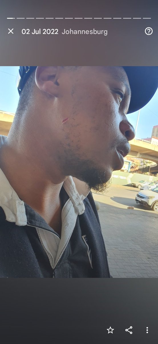 MncubeAllen's tweet photo. @_Pelo_the_first You stabbed me on my face, spoke to me carry a knife. Couldn't sleep in my apartment. This is gone too far https://t.co/5sbjZb4NK2