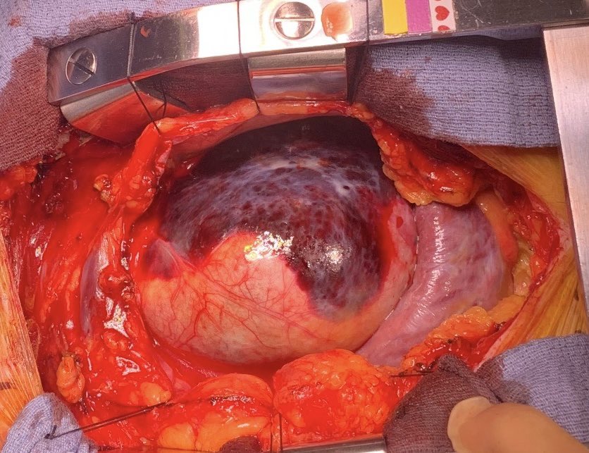 Ioannis Loumiotis MD tweet media