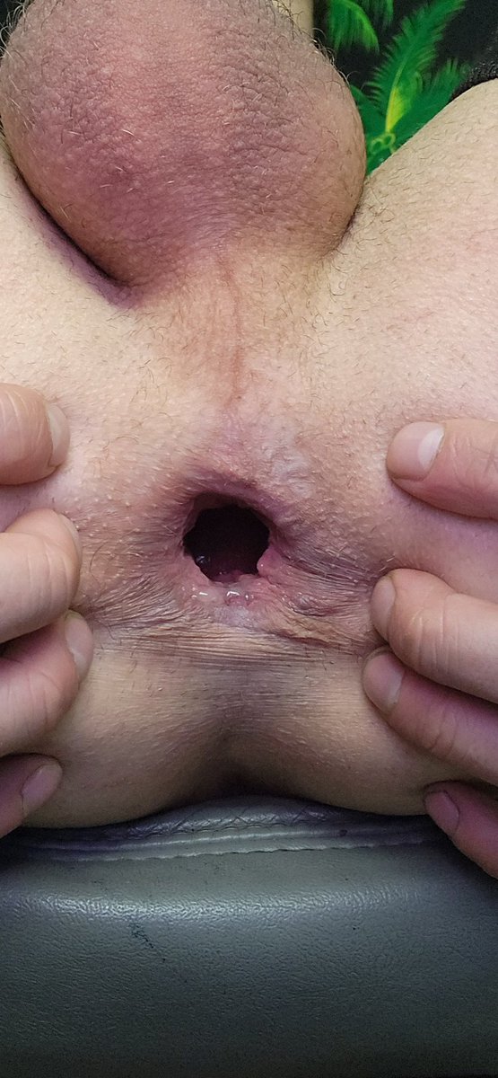 KealeRicky's tweet photo. Just showing off my gape and rosebud . Hope you enjoy 😉 https://t.co/bYjMwROvgL