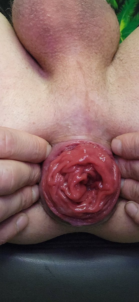 KealeRicky's tweet photo. Just showing off my gape and rosebud . Hope you enjoy 😉 https://t.co/bYjMwROvgL