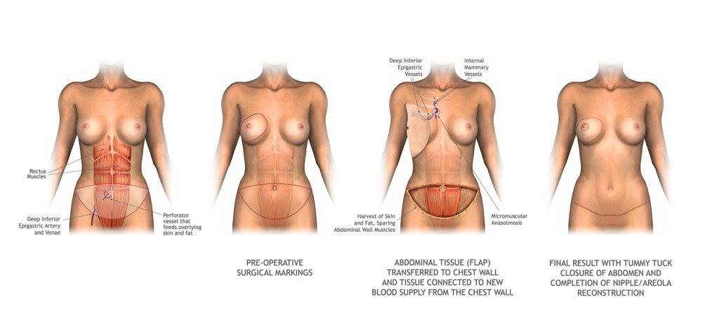 Breast Advocate tweet media