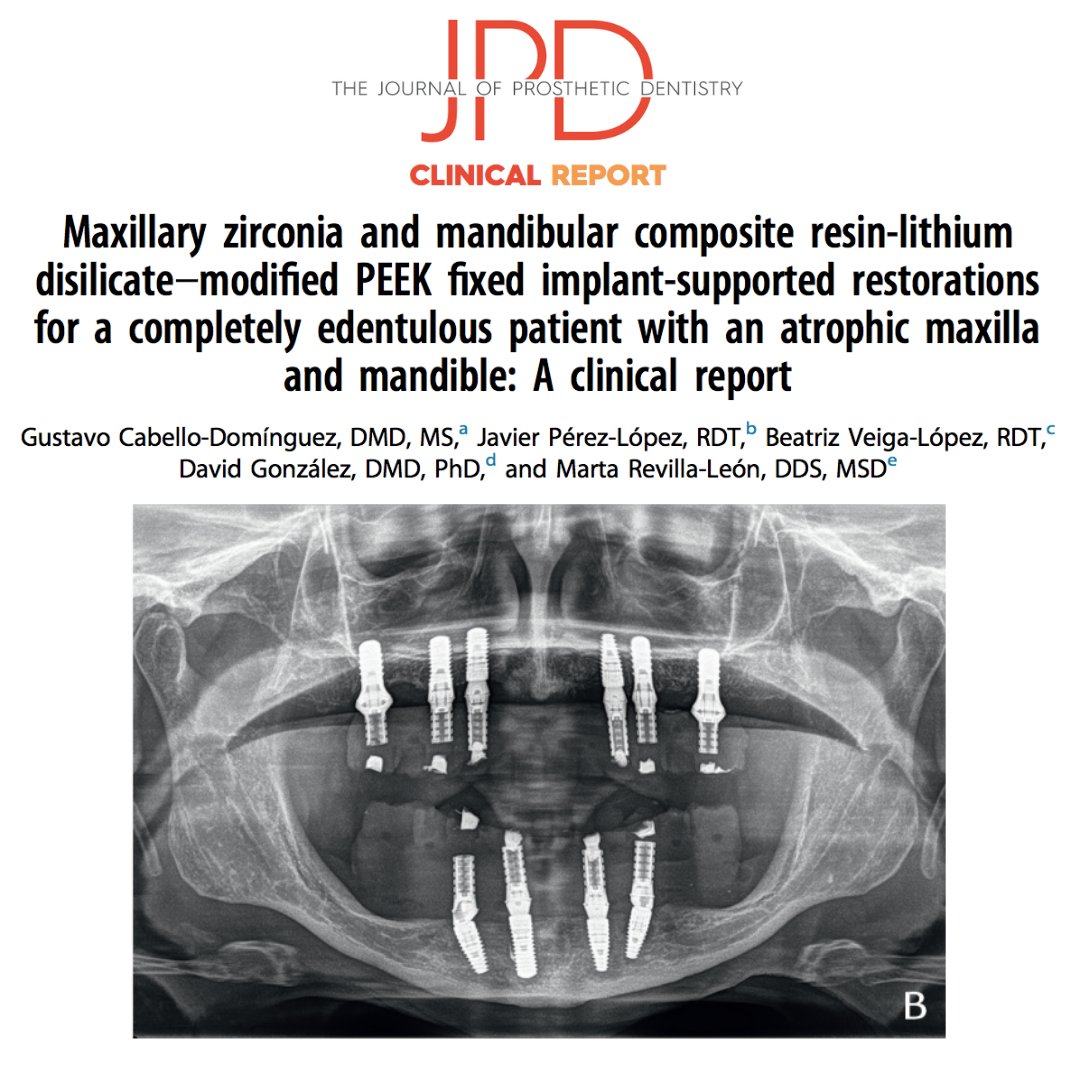 JPDentistry's tweet photo. This #casereport shows how to combine different #CADCAM #dentalmaterials in full arch #implantprostheses consisting of #PEEK #implant framework with cemented #lithiumdisilicate #crowns against monolithic #zirconia. Learn more: https://t.co/u1cY2n9YUk https://t.co/b045JRjOHE