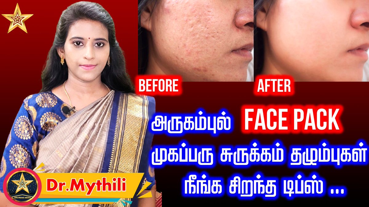 அருகம்புல் Face Pack - முகப்பரு சுருக்கம் தழும்புகள் நீங்க சிறந்த டிப்ஸ் | Dr Mythili youtu.be/WY427Fzadcg arugampul uses in tamil
arugampul face pack tamil
arugampul juice
arugampul face pack in tamil,