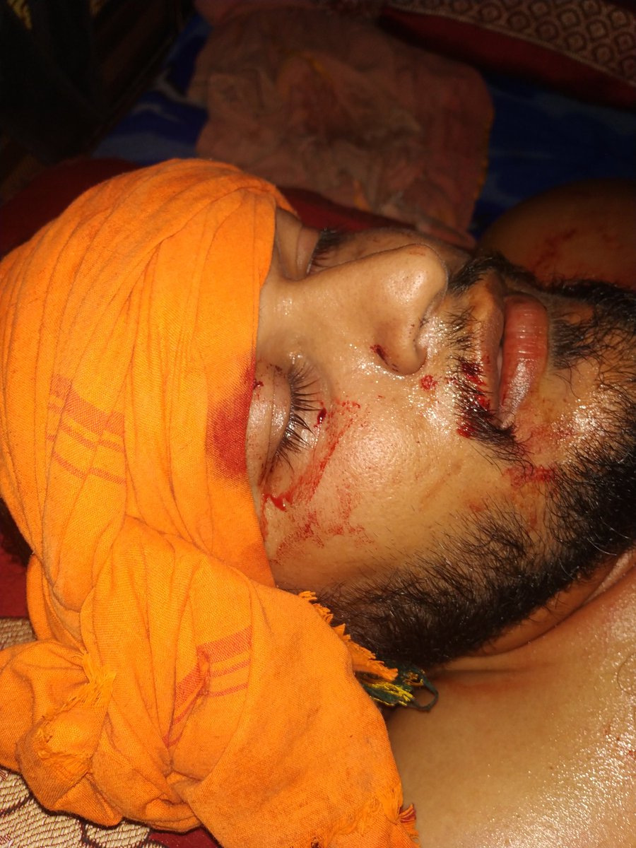 devpathakjanfi4's tweet photo. @doctorrichabjp Nice Interview @doctorrichabjp ji however, I have been victim of assault in Sultanpur Uttar Pradesh..FIR has been ladged in Lambhua PS #0282  and it's been 20 days with no action... I have part of BJYM ..need your help on this... please find my pic of assault...DM for details! https://t.co/KjubbBfr3F