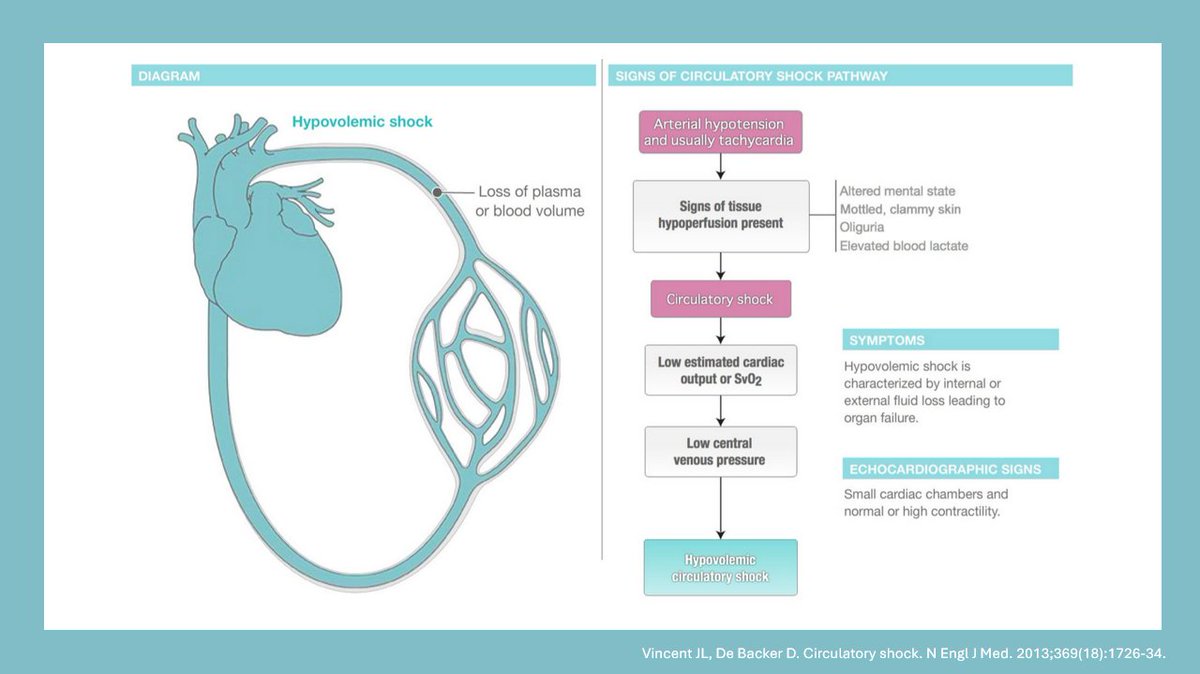 NephroP's tweet photo. Shock
#POCUS #MedEd #CriticalCare #Nephrology https://t.co/1QftExOGoR