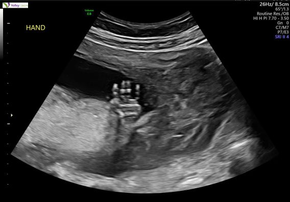 Micky Monero tweet media