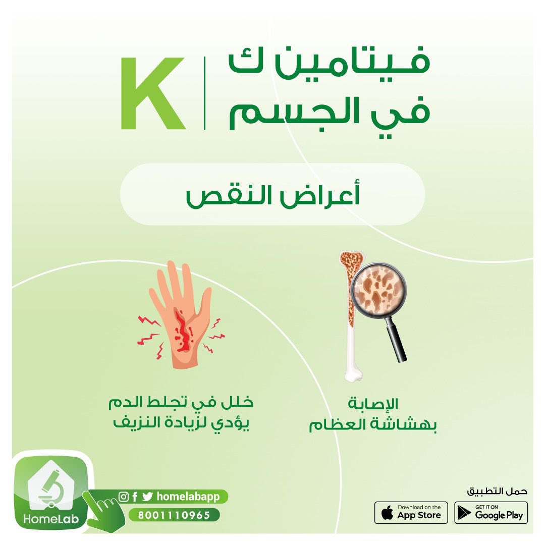 اش سبب هشاشة العظام ؟ 😖
تعتبر من أهم أعراض نقص فيتامين ( ك ) 
افحص الان وخليك مطمن 💪

مع #هوم_لاب نخدمك وأنت بمكانك 💉 

حمل التطبيق آلان 📲
 
onelink.to/4av4pf