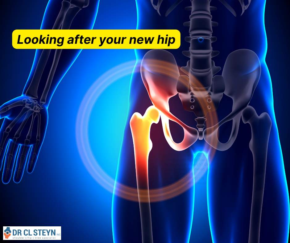 DrCLSteyn's tweet photo. Looking after your new hip Dr. CL Steyn Inc - Shoulder Surgeon - Cape Town https://t.co/ftJyVRUwXS #drclsteyn #kneesurgery #orthopaedicsurgeon #shoulderdoc #shouldersurgery https://t.co/W6U6HsEaCe