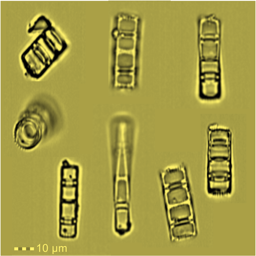 DrAnnPower's tweet photo. Diatoms in lake sediment captured using #imagingflowcytomery
Any experts out there know what types of diatoms we are looking at? I can't keep classifying them as 'Ladders' forever! #microscopy #luminex #imagestream #flowcytometry #science #diatom #paleolimnology https://t.co/HUChbw5env
