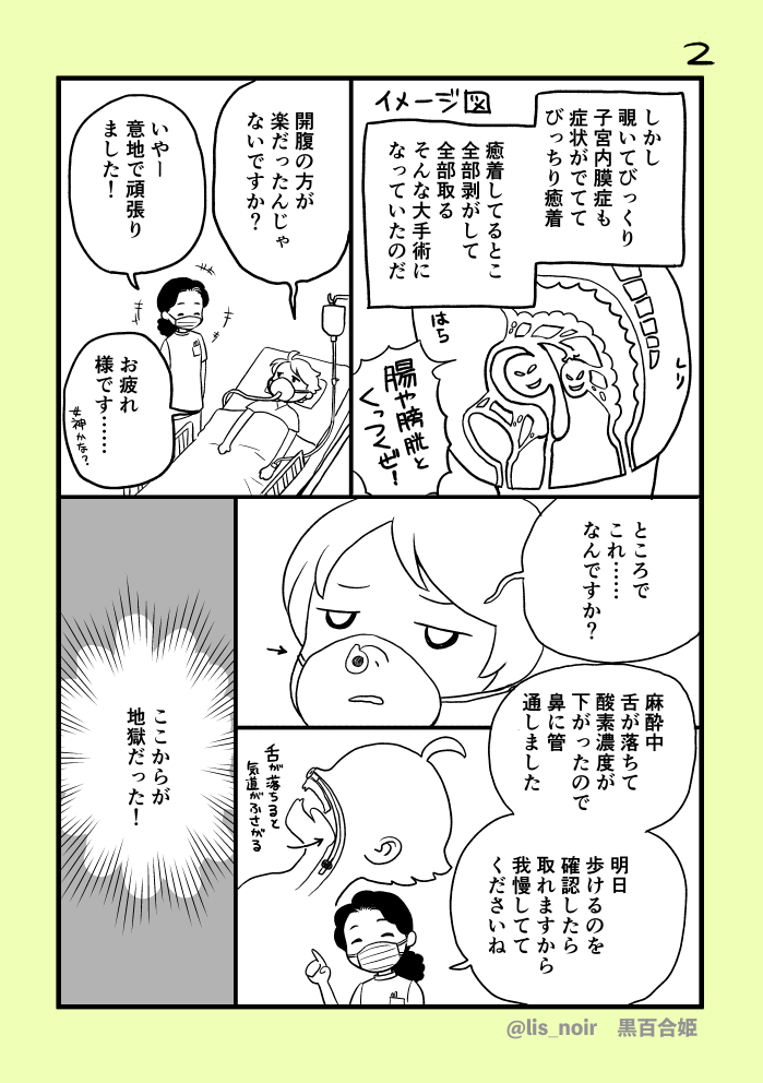 術後のお話。麻酔がちょっと残ってる体でうとうとするって、めちゃくちゃ気持ちいいですね。(でも痛みで強制的に起こされる)
#絵日記 #日記漫画 #くろゆり日記 https://t.co/Id0DXQhmtV 