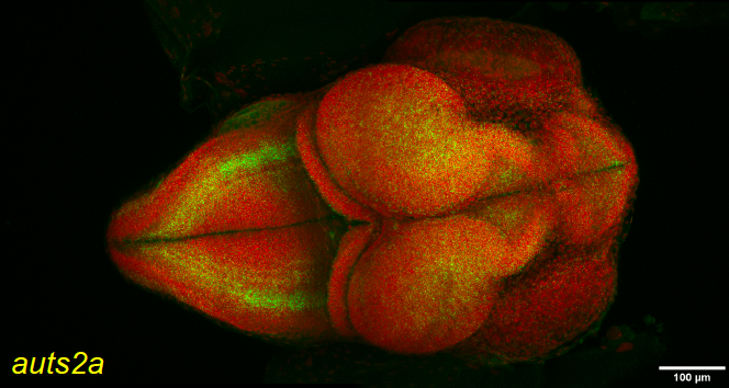 auts2 Features and Expression Are Highly Conserved during Evolution Despite Different Evolutionary Fates Following Whole Genome Duplication mdpi.com/1802504 #mdpicells via <a href="/MDPIOpenAccess/">MDPI</a>